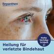 Bepanthen Augen- und Nasensalbe zur F&ouml;rderung der Wundheilung - 5