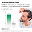 Alopexy 5% L&ouml;sung - 7