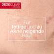Dexeryl Dexeclear Reinigungsgel schäumend für unreine Haut - 4
