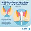 Postericare Hämorrhoiden-Stick - 4