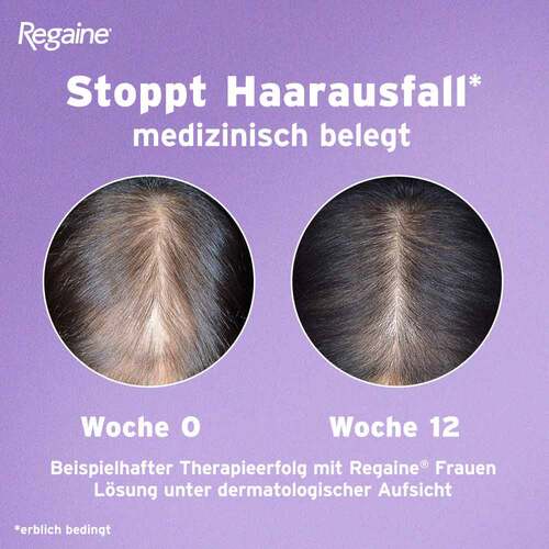 Regaine Frauen Schaum 50 mg/g - 5