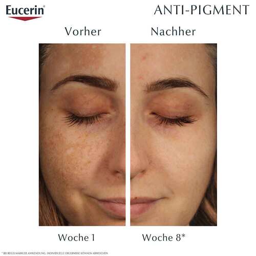 Eucerin Anti-Pigment Dual Serum - Pigmentflecken - 4