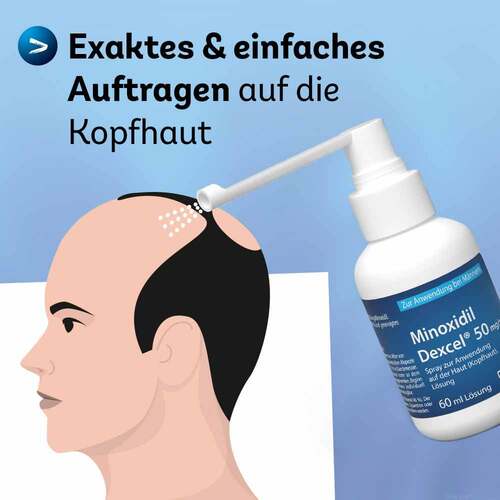 Minoxidil Dexcel 50 mg / ml Spray z.Anw.a.d.Kopfhaut - 5