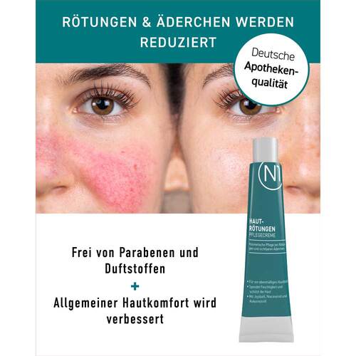 N1 Hautr&ouml;tungen Pflegecreme - 6