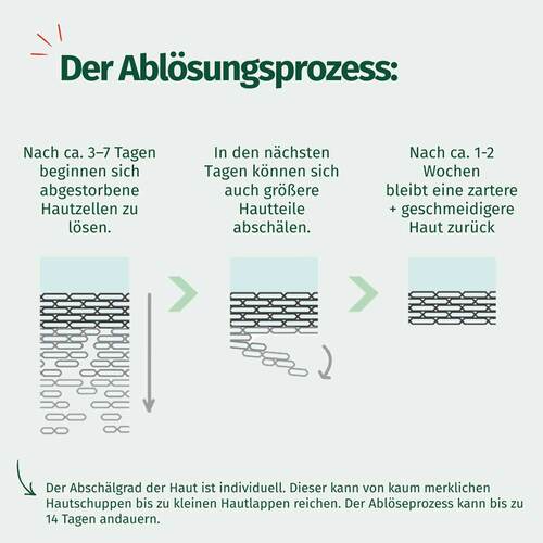 Allg&auml;uer Latschenkiefer Hornhaut Entferner Maske Cremig - 6